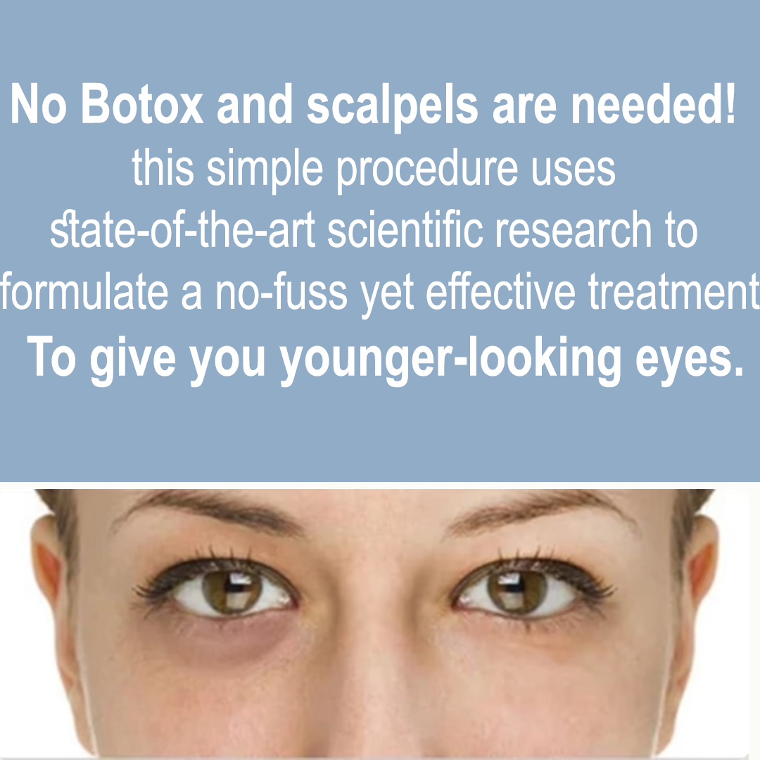 Non-Surgical Eye lift