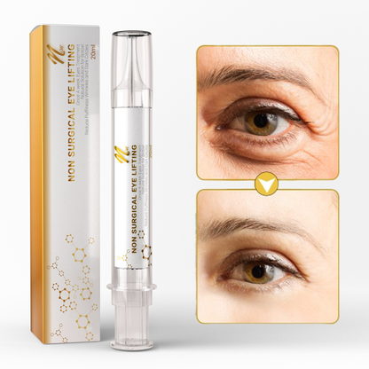 Non-Surgical Eye lift